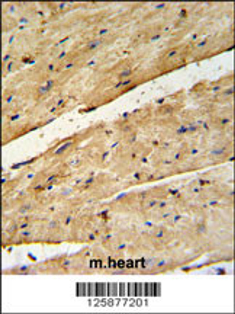 B3GNT7 Antibody IHC analysis in formalin fixed and paraffin embedded mouse heart tissue followed by peroxidase conjugation of the secondary antibody and DAB staining.