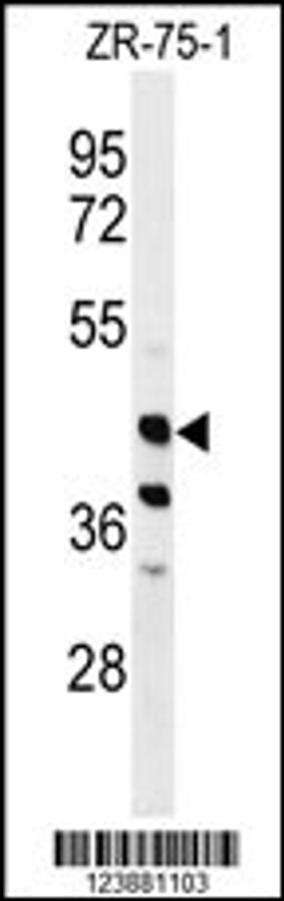 Western blot analysis of FA2H Antibody in ZR-75-1 cell line lysates (35ug/lane)