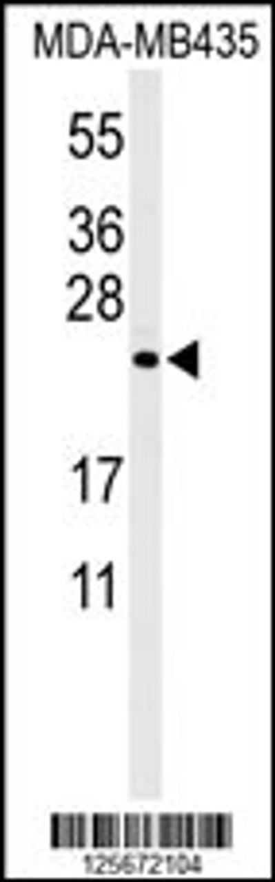 Western blot analysis of ZCH24 Antibody in MDA-MB435 cell line lysates (35ug/lane)