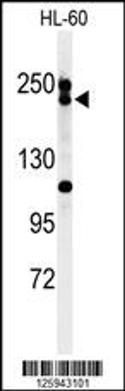 Western blot analysis of BLM Antibody in HL-60 cell line lysates (35ug/lane)