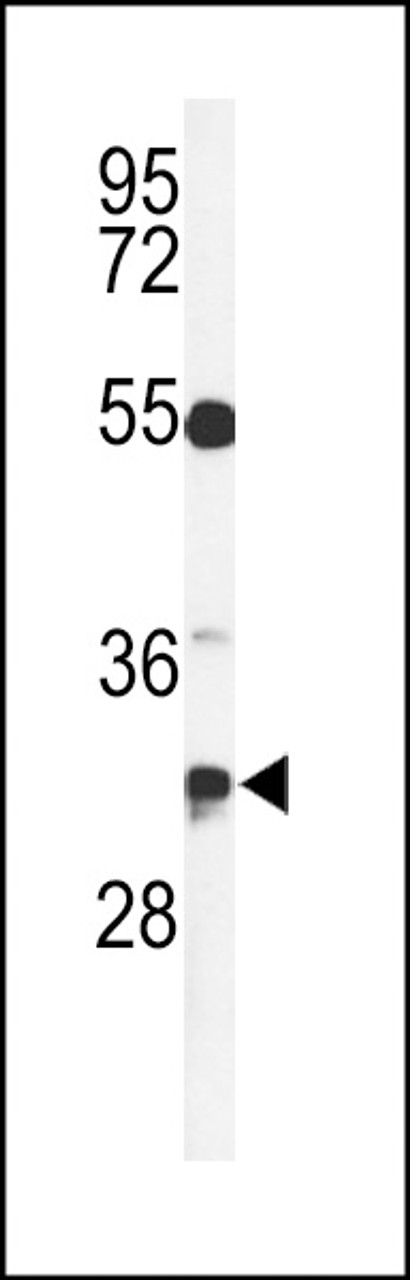 Western blot analysis of TSPAN7 Antibody in CEM cell line lysates (35ug/lane)