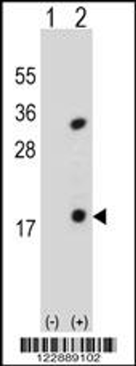 Western blot analysis of PLA2G1B using rabbit polyclonal PLA2G1B Antibody using 293 cell lysates (2 ug/lane) either nontransfected (Lane 1) or transiently transfected (Lane 2) with the PLA2G1B gene.