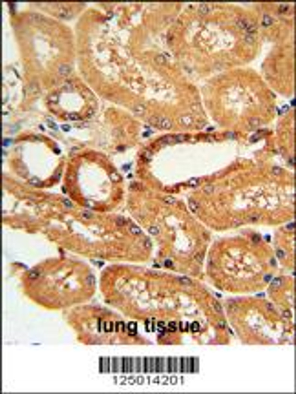 COQ9 Antibody immunohistochemistry analysis in formalin fixed and paraffin embedded human lung tissue followed by peroxidase conjugation of the secondary antibody and DAB staining.