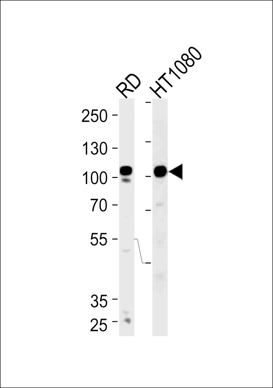Western blot analysis of lysates from RD, HT1080 cell line (from left to right) , using ATP2A1 Antibody .AP4905b was diluted at 1:1000 at each lane.