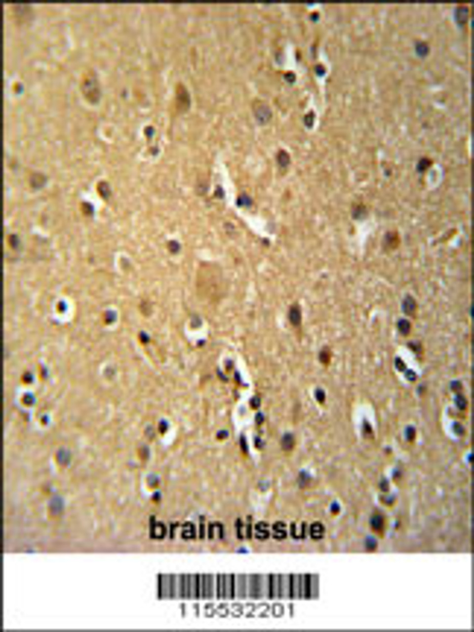 TNFRSF8-Y479 Antibody immunohistochemistry analysis in formalin fixed and paraffin embedded human brain tissue followed by peroxidase conjugation of the secondary antibody and DAB staining. This data demonstrates the use of the TNFRSF8-Y479 Antibody for immunohistochemistry.