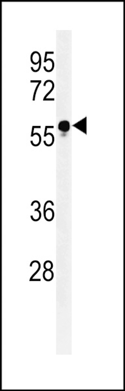 Western blot analysis of FUT6 Antibody in HL-60 cell line lysates (35ug/lane)