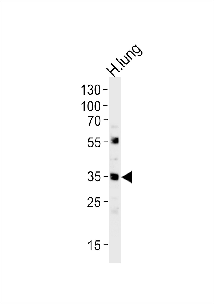 Western blot analysis of lysate from human lung tissue lysate, using MFAP4 Antibody at 1:1000 at each lane.