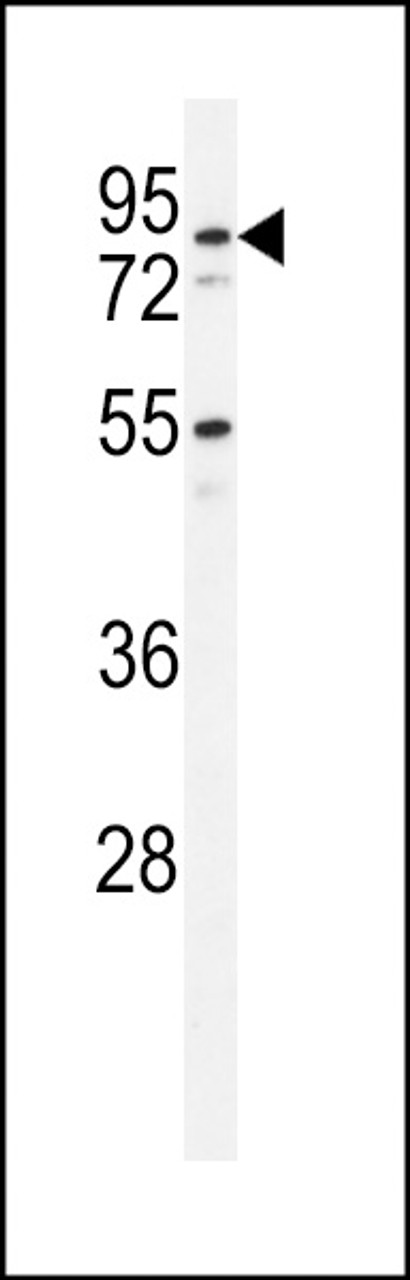 Western blot analysis of PDXD1 Antibody in HL-60 cell line lysates (35ug/lane)