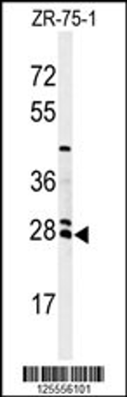Western blot analysis of NAT8 Antibody in ZR-75-1 cell line lysates (35ug/lane)