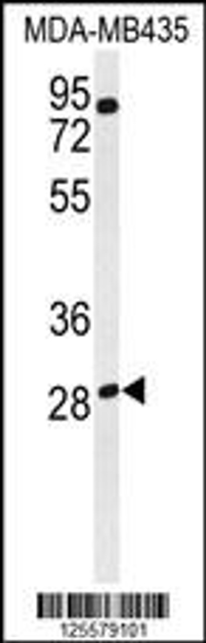 Western blot analysis of RRAGD Antibody in MDA-MB435 cell line lysates (35ug/lane)