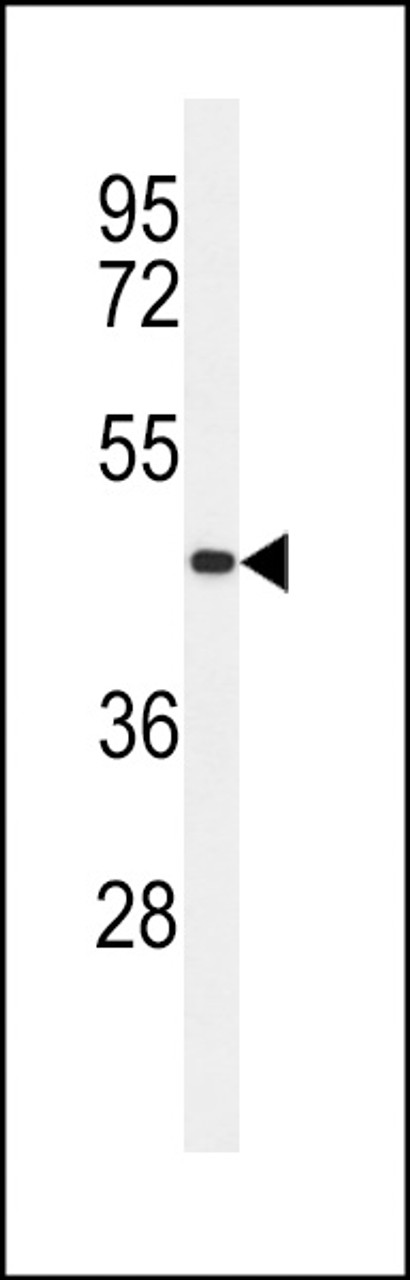 Western blot analysis of CC50B Antibody in MDA-MB435 cell line lysates (35ug/lane)