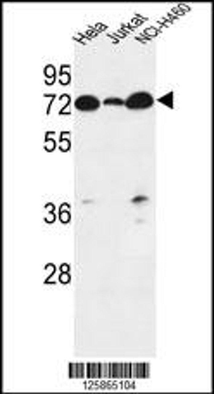 Western blot analysis in Hela, Jurkat, NCI-H460 cell line lysates (35ug/lane) .