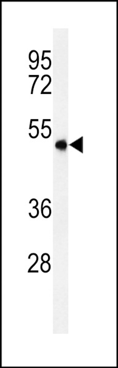Western blot analysis of ASM3A Antibody in MDA-MB435 cell line lysates (35ug/lane)