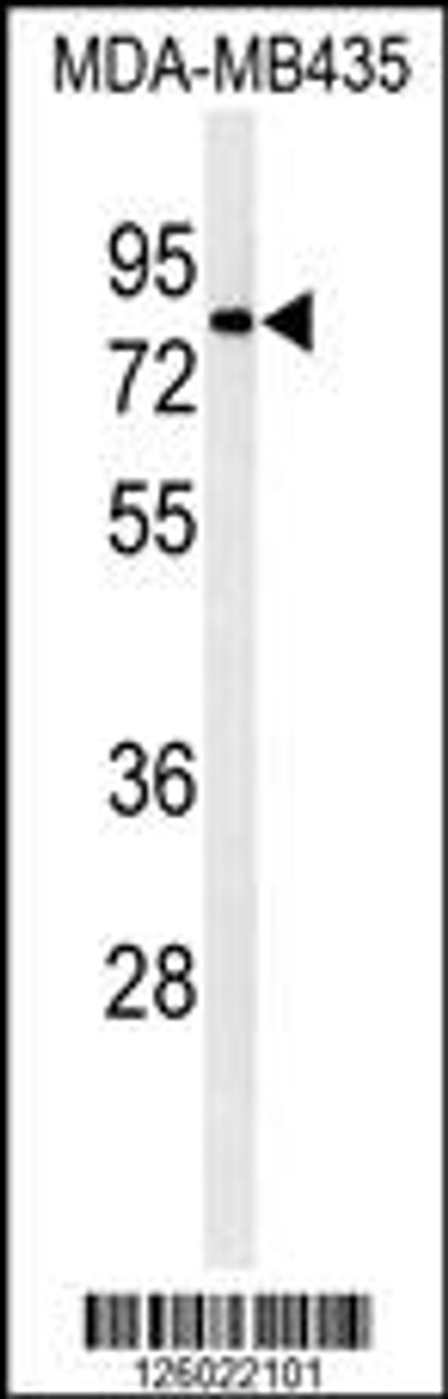 Western blot analysis of ATHL1 Antibody in MDA-MB435 cell line lysates (35ug/lane)