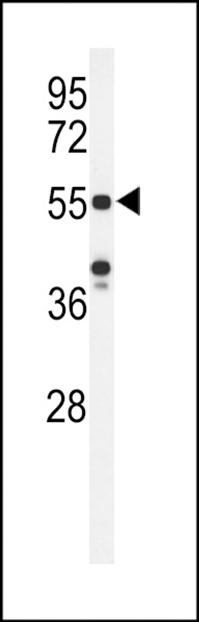 Western blot analysis of POTEH Antibody in Hela cell line lysates (35ug/lane)