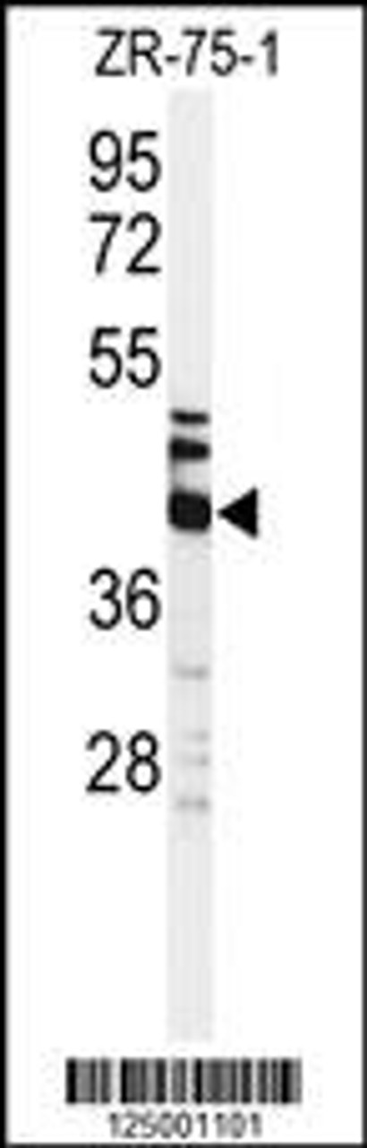 Western blot analysis of KRT35 Antibody in ZR-75-1 cell line lysates (35ug/lane)