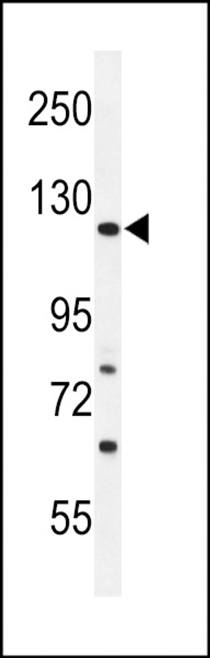 (LEFT) Western blot analysis of ARHGAP30 Antibody in Ramos cell line lysates (35ug/lane) .ARHGAP30 (arrow) was detected using the purified Pab. (RIGHT) Western blot analysis of ARHGAP30 Antibody in mouse NIH-3T3 cell line lysates (35ug/lane) .ARHGAP30 (arrow) was detected using the purified Pab.
