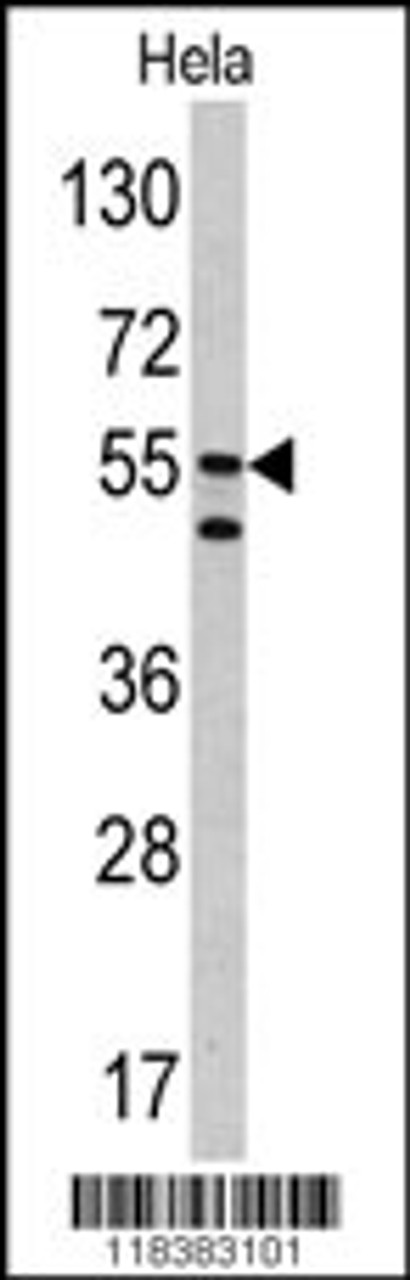 Western blot analysis of CA9 antibody in Hela cell line lysates (35ug/lane)