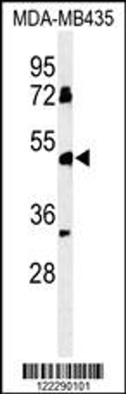 Western blot analysis of BTNL8 Antibody in MDA-MB435 cell line lysates (35ug/lane)
