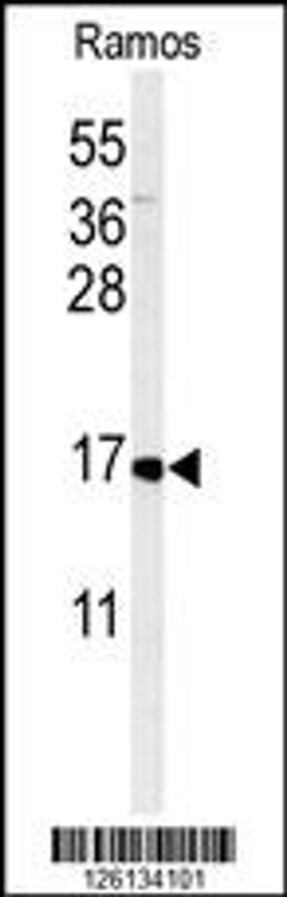 Western blot analysis of CMTM7 Antibody in Ramos cell line lysates (35ug/lane)