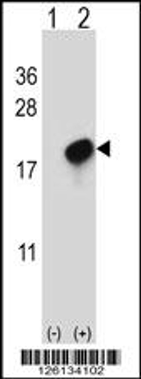 Western blot analysis of CMTM7 using rabbit polyclonal CMTM7 Antibody using 293 cell lysates (2 ug/lane) either nontransfected (Lane 1) or transiently transfected (Lane 2) with the CMTM7 gene.