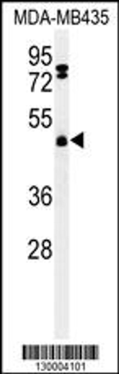 Western blot analysis of FBXL2 Antibody in MDA-MB435 cell line lysates (35ug/lane)
