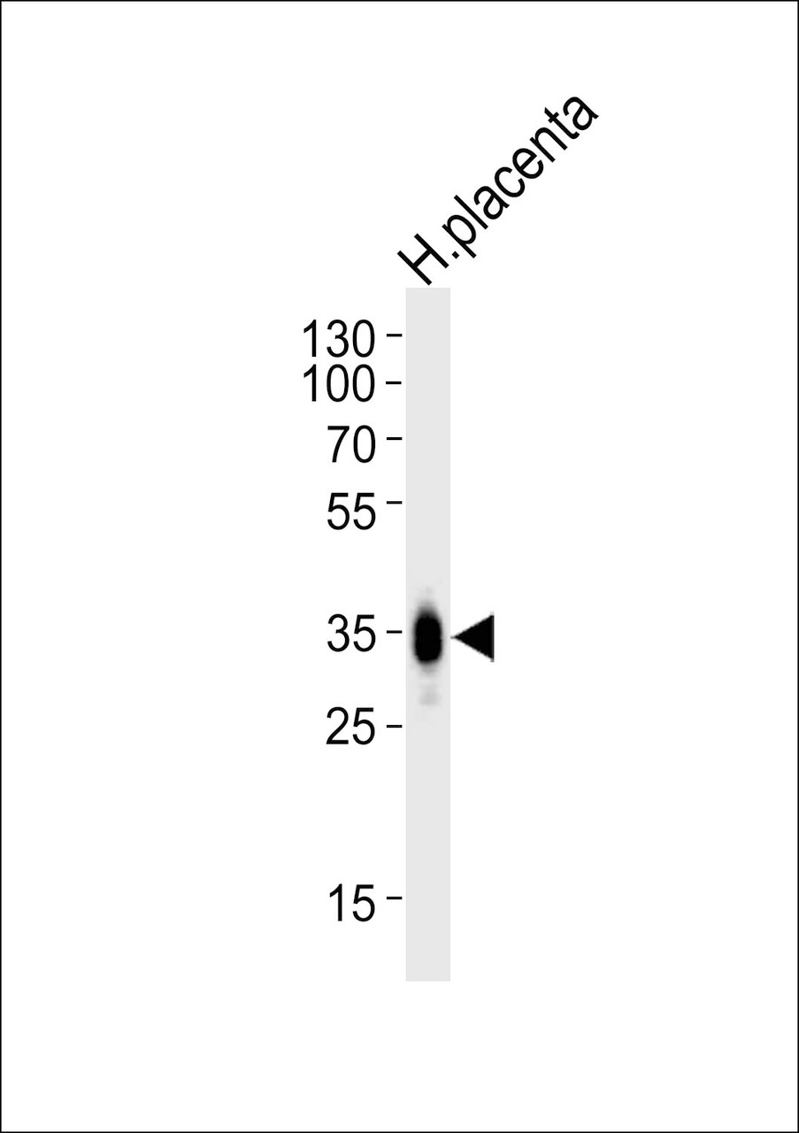 Western blot analysis of lysate from human placenta tissue, using FOLR2 Antibody at 1:1000.