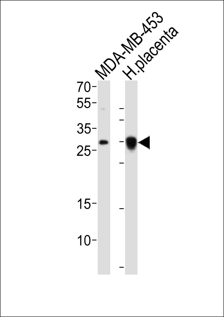 Western blot analysis of lysates from MDA-MB-453 cell line, human placenta tissue lysate (from left to right) , using FOLR2 Antibody at 1:1000 at each lane.