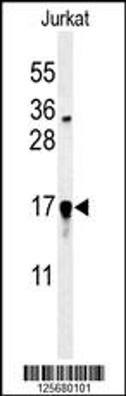 Western blot analysis of GLRX5 Antibody in Jurkat cell line lysates (35ug/lane)