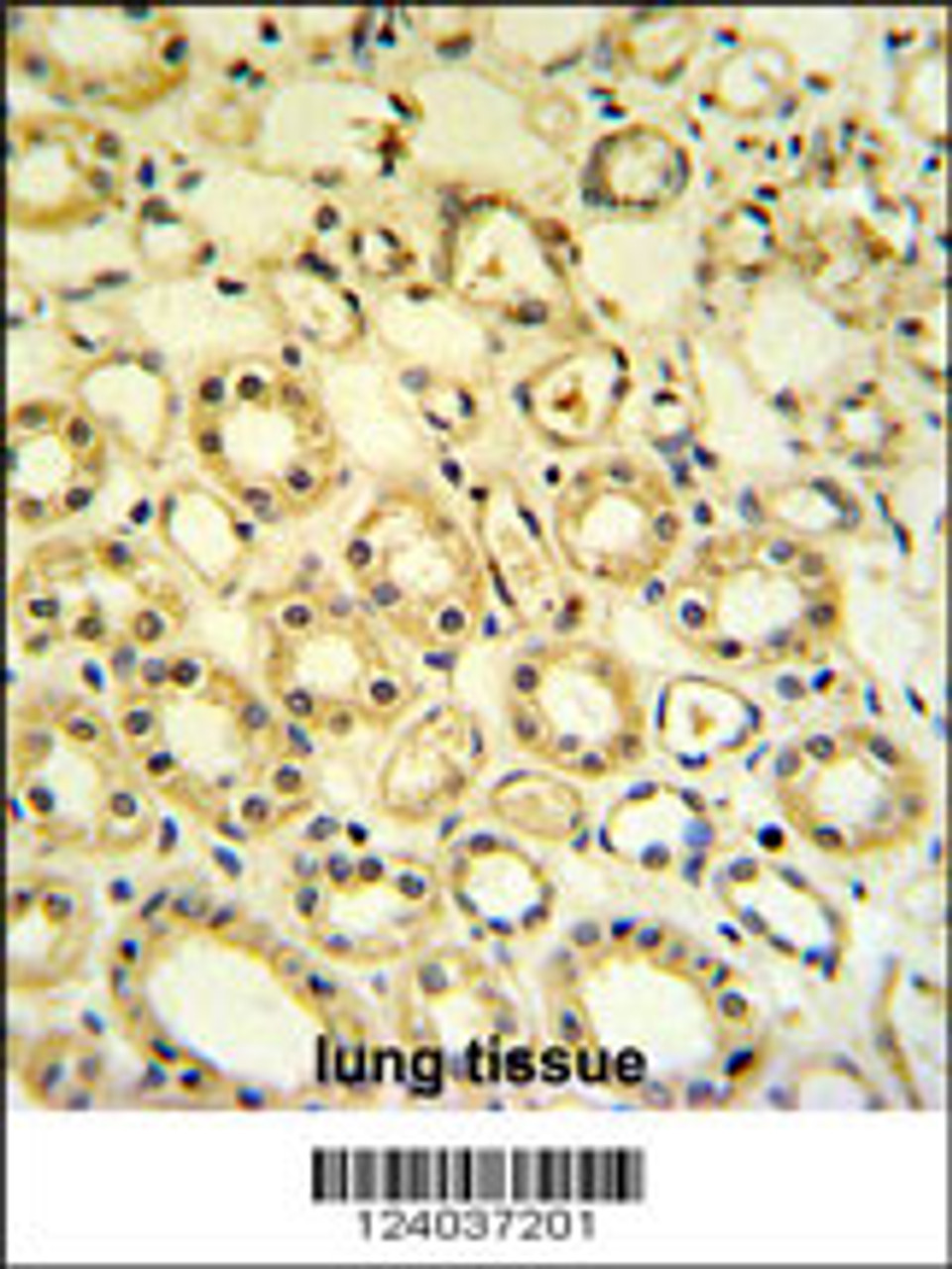 H6PD Antibody IHC analysis in formalin fixed and paraffin embedded lung tissue followed by peroxidase conjugation of the secondary antibody and DAB staining.