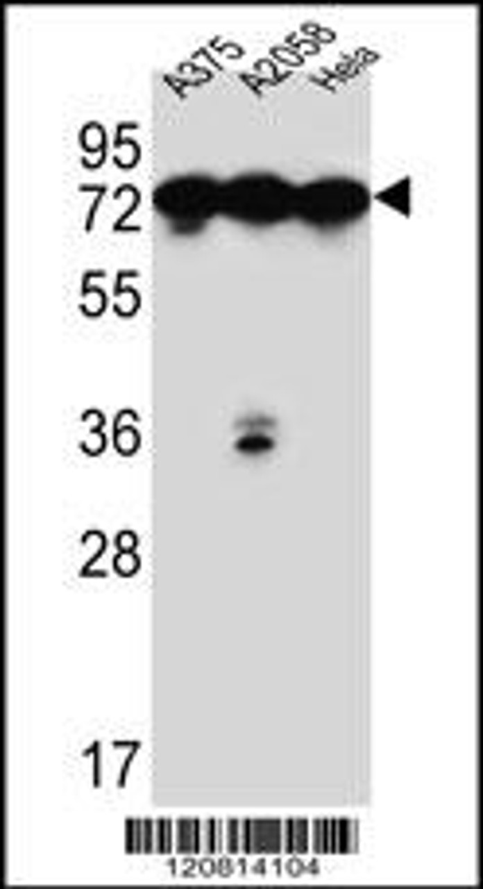 Western blot analysis in A375, A2058, Hela cell line lysates (35ug/lane) .