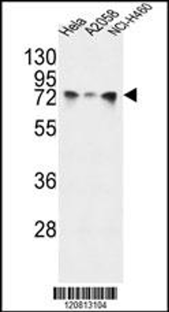 Western blot analysis in Hela, A2058, NCI-H460 cell line lysates (35ug/lane) .