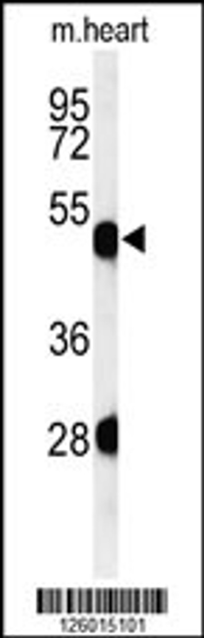 Western blot analysis of KRT82 Antibody in mouse heart tissue lysates (35ug/lane)