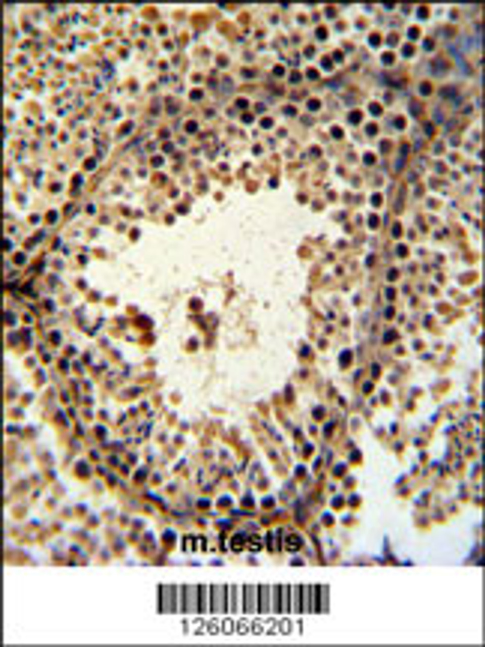 PHF13 Antibody IHC analysis in formalin fixed and paraffin embedded mouse testis tissue followed by peroxidase conjugation of the secondary antibody and DAB staining.