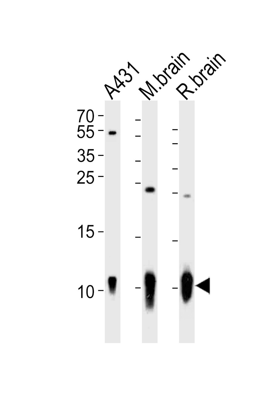 Western blot analysis of lysates from A431 cell line, mouse brain, rat brain tissue (from left to right) , using S100B Antibody at 1:1000 at each lane.