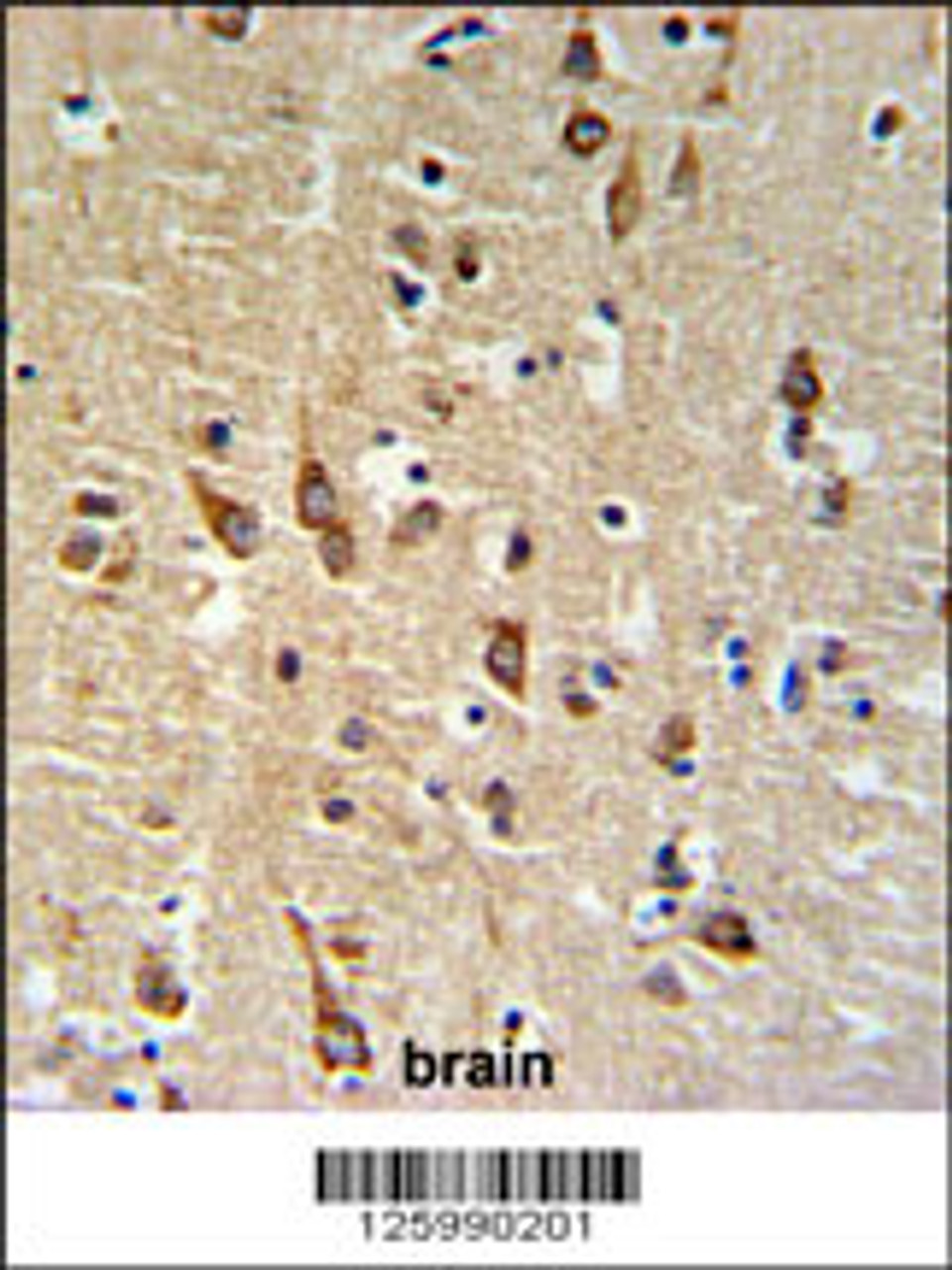 SGTB Antibody IHC analysis in formalin fixed and paraffin embedded human brain tissue followed by peroxidase conjugation of the secondary antibody and DAB staining.