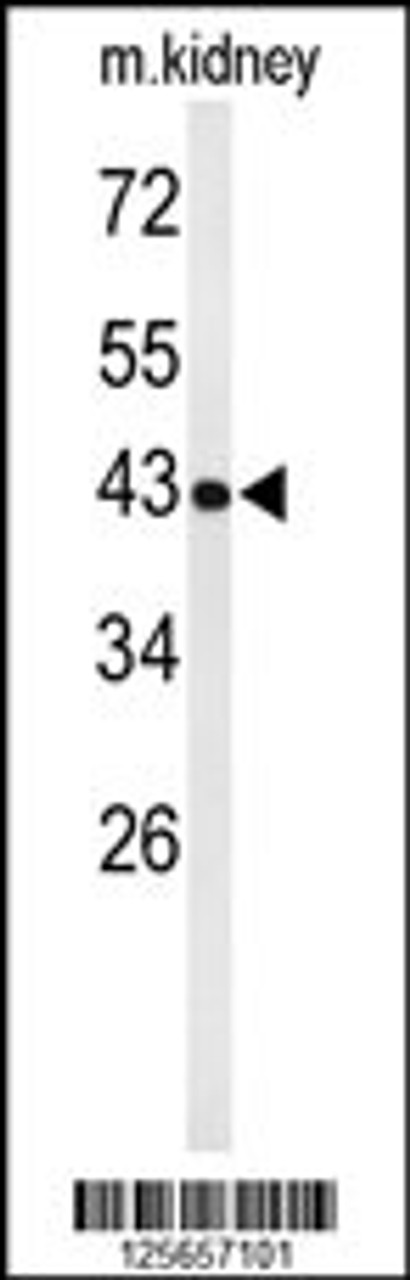 Western blot analysis of UBXN6 Antibody in mouse kidney tissue lysates (35ug/lane)