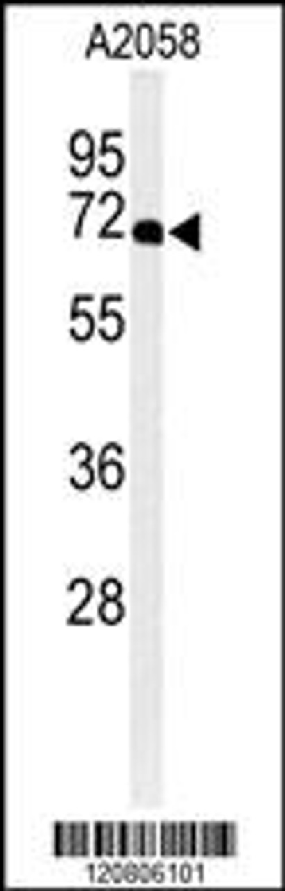 Western blot analysis of XRCC6 Antibody in A2058 cell line lysates (35ug/lane)