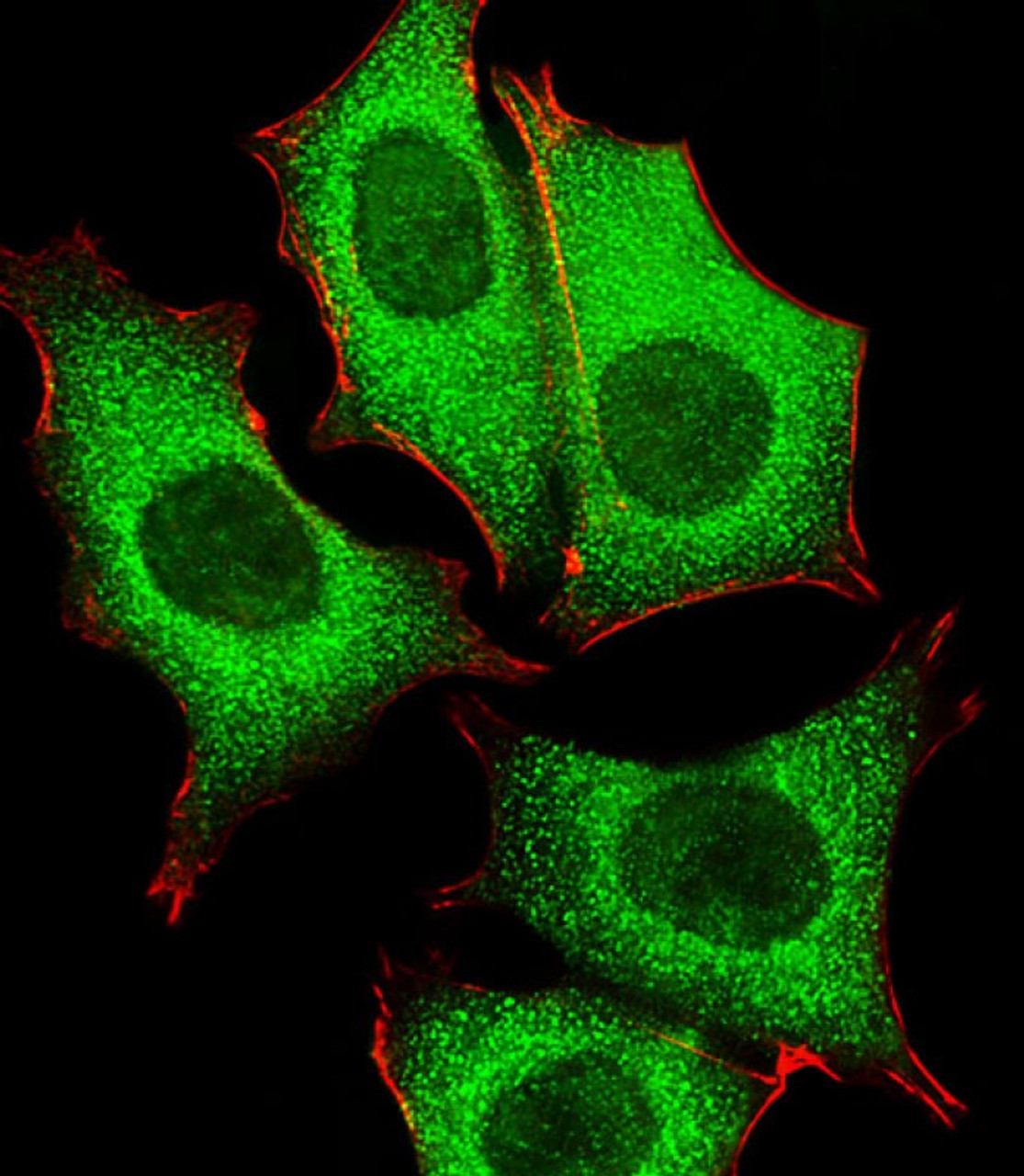 Fluorescent image of MCF-7 cells stained with GLD2 Antibody (N-term) . AP5092a was diluted at 1:25 dilution. An Alexa Fluor 488-conjugated goat anti-rabbit lgG at 1:400 dilution was used as the secondary antibody (green) . Cytoplasmic actin was counterstained with Alexa Fluor 555 conjugated with Phalloidin (red) .