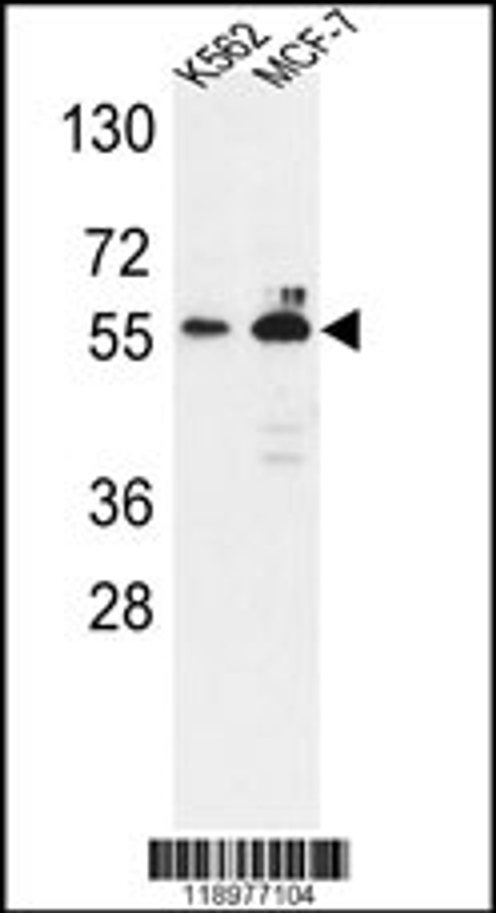 Western blot analysis of G6PD Antibody in K562, MCF-7 cell line lysates (35ug/lane)