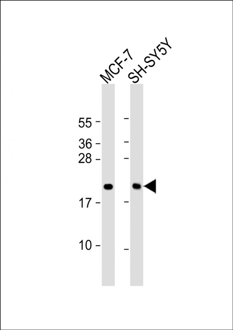 Western Blot at 1:2000 dilution Lane 1: MCF-7 whole cell lysate Lane 2: SH-SY5Y whole cell lysate Lysates/proteins at 20 ug per lane.