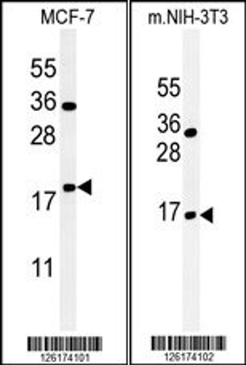 (LEFT) Western blot analysis of BTG1 Antibody in MCF-7 cell line lysates (35ug/lane) .BTG1 (arrow) was detected using the purified Pab. (RIGHT) Western blot analysis of BTG1 Antibody in mouse NIH-3T3 tissue lysates (35ug/lane) .BTG1 (arrow) was detected using the purified Pab.