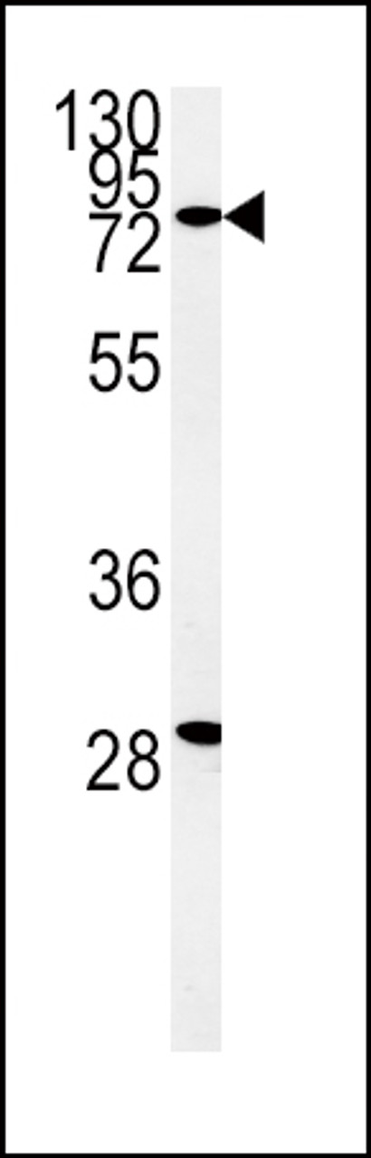 Western blot analysis of ZFYVE16 Antibody in K562 cell line lysates (35ug/lane)