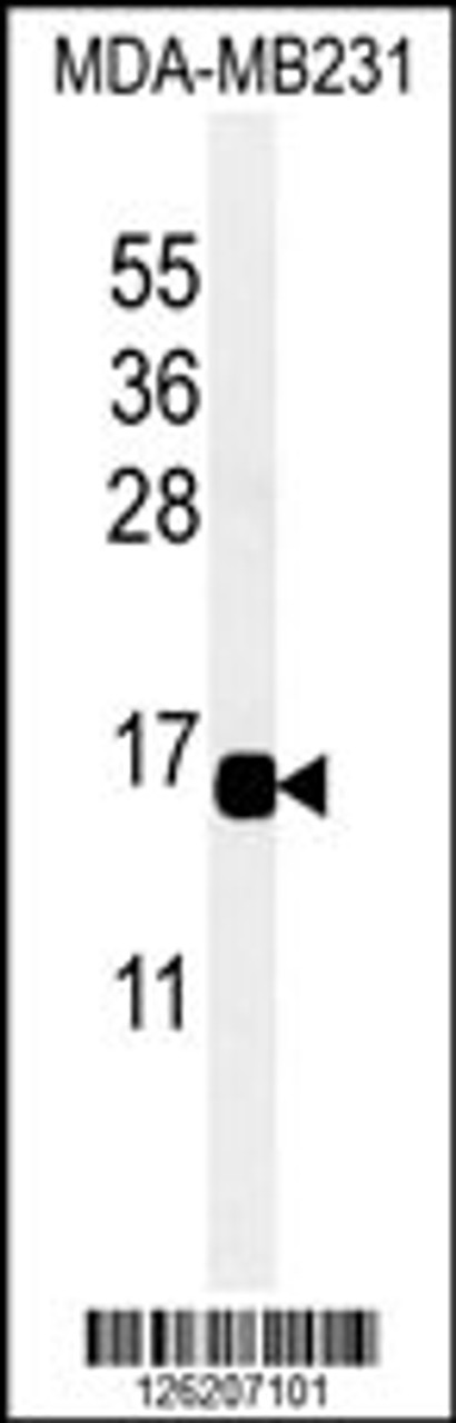 Western blot analysis of CXCL9 Antibody in MDA-MB231 cell line lysates (35ug/lane)