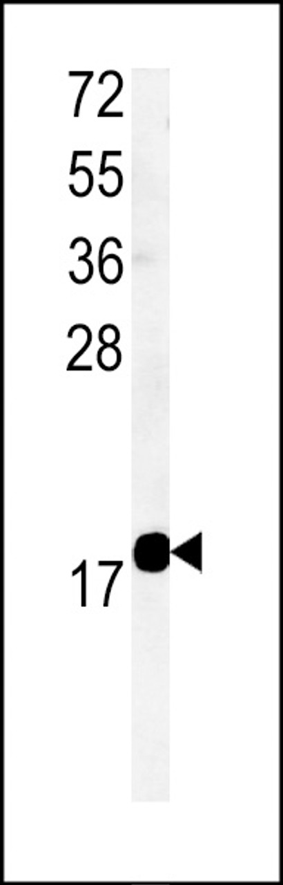 Western blot analysis of TM222 Antibody in mouse bladder tissue lysates (35ug/lane)