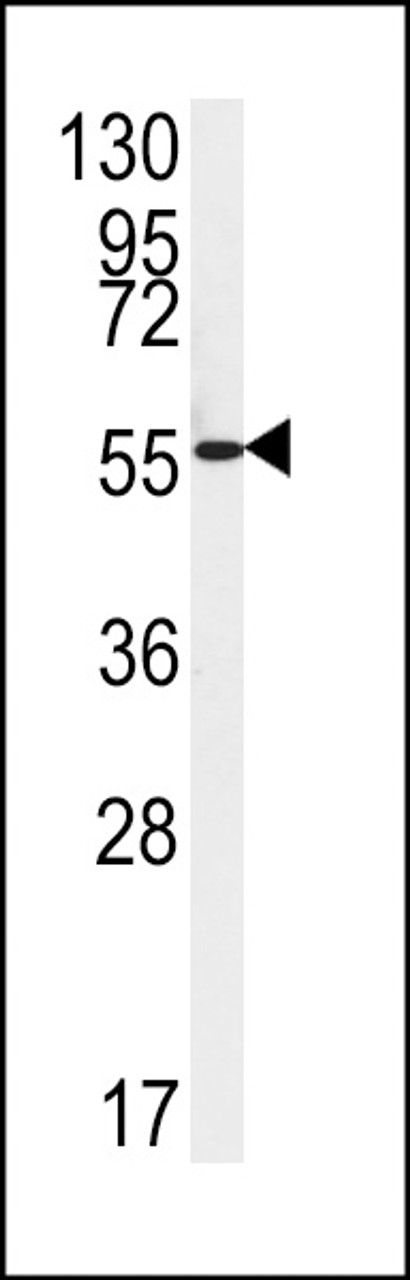 Western blot analysis of FAAH2 Antibody in HepG2 cell line lysates (35ug/lane)