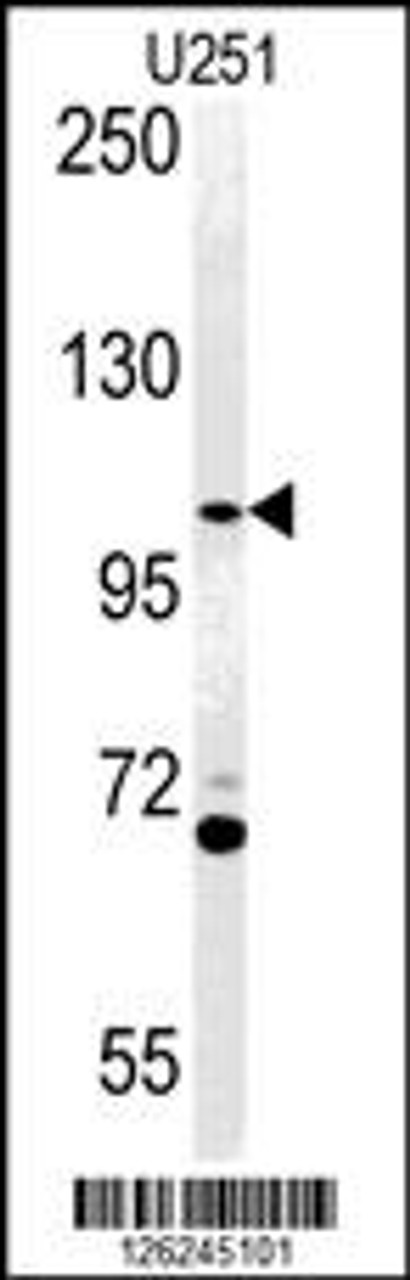 Western blot analysis of ACAP3 Antibody in U251 cell line lysates (35ug/lane)