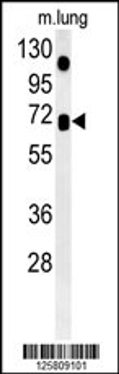 Western blot analysis in mouse lung tissue lysates (35ug/lane) .This demonstrates the detected ASB15 protein (arrow) .