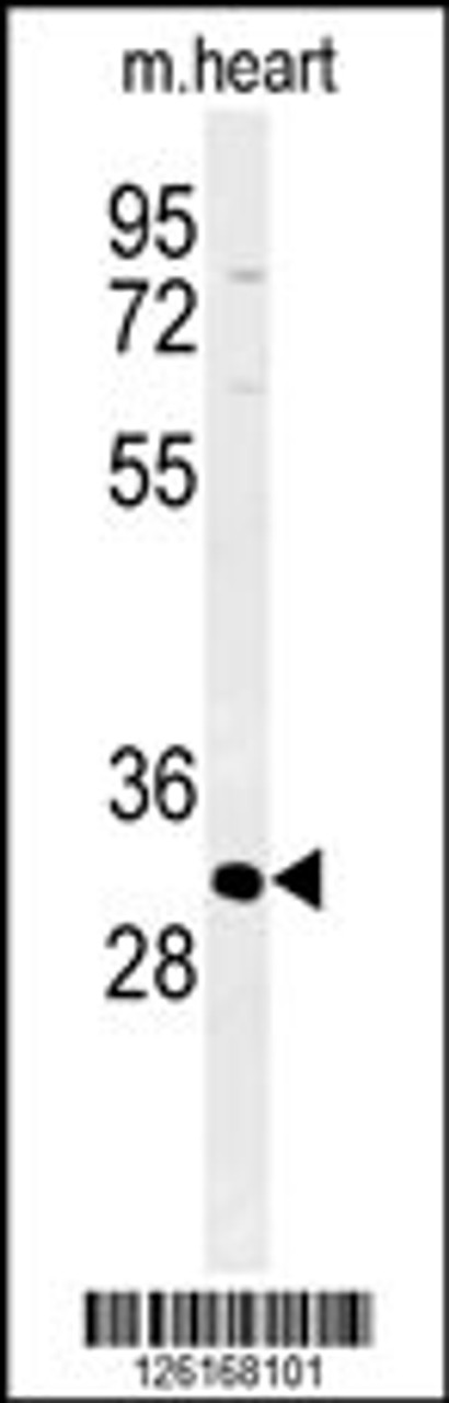 Western blot analysis of ATP4B Antibody in mouse heart tissue lysates (35ug/lane)