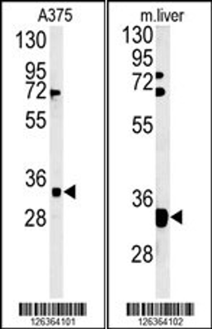 (LEFT) Western blot analysis of FYTD1 Antibody in A375 cell line lysates (35ug/lane) .FYTD1 (arrow) was detected using the purified Pab. (RIGHT) Western blot analysis of FYTD1 Antibody in mouse liver tissue lysates (35ug/lane) .FYTD1 (arrow) was detected using the purified Pab.